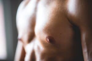 Adult Gynecomastia Surgery Phoenix