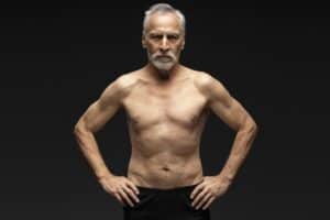 Senior Gynecomastia Surgery Phoenix